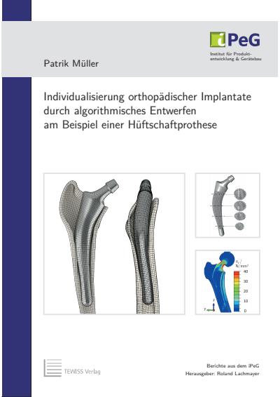 Cover des Buchs: Individualisierung orthopädischer Implantate durch algorithmisches Entwerfen am Beispiel einer Hüftschaftprothese